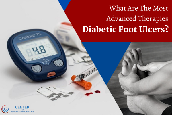 Arterial Vs. Venous Ulcers - Understand The Difference